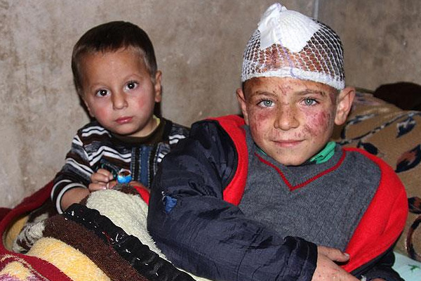 Halep'te yaralanan çocuk yaşadıklarını anlattı