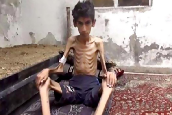 Yardım görevlilerinin gözleri önünde açlıktan öldü