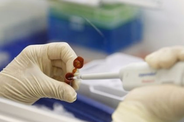 Domuz gribinden ölümler artıyor