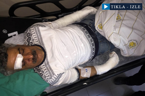 HDP'yi eleştiren Kürt sanatçı saldırıya uğradı