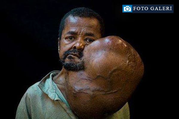 İlginç tıp olayları