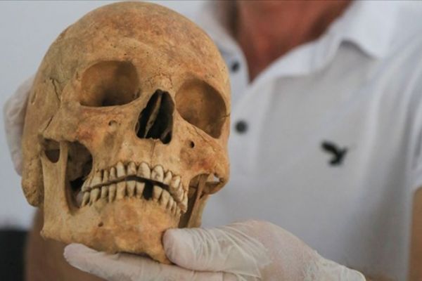 Euromos'ta '2 bin 200 yıllık beyin ameliyatı' izleri