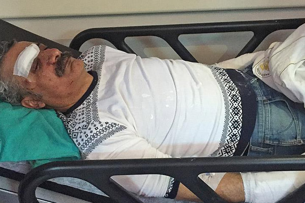 Şarkıcı Çiyager'in darbedilmesinde 2 gözaltı