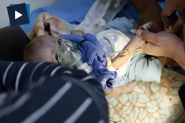 Guta çocukları sağlık ablukasında