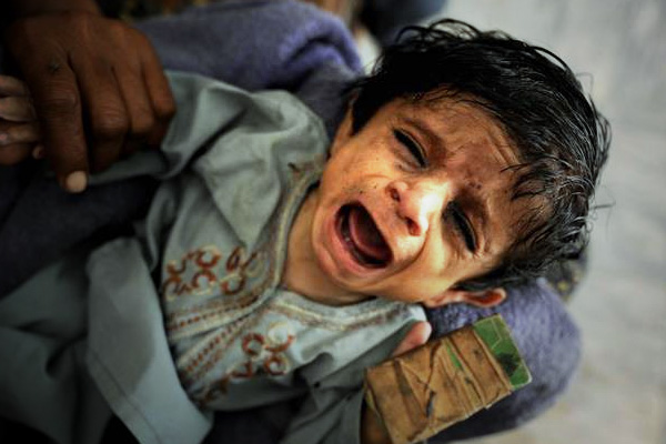 Pakistan'da kuraklık çocukları vurdu: 143 ölü