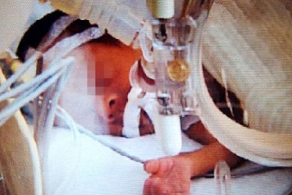 Morgda bekletilen bebek canlandı