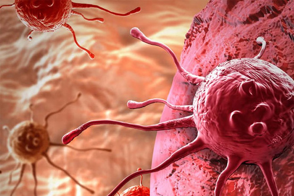 Kanser tedavisinde yeni umut