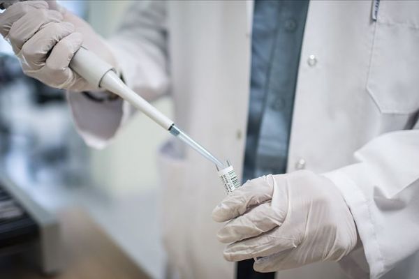 HIV'in yeni bir türü saptandı