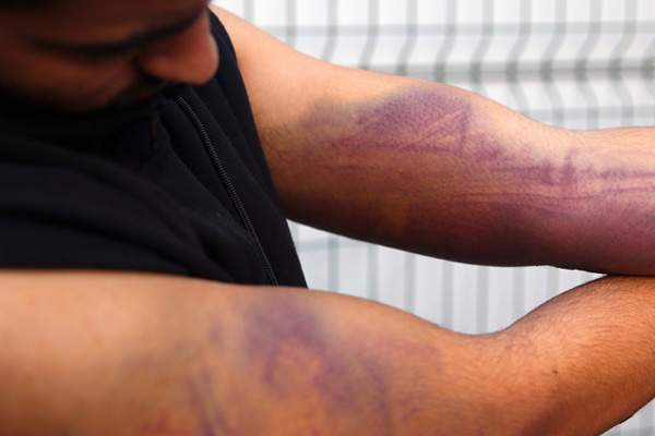 'Yunan askerleri göçmenleri silahla dövdü'' iddiası