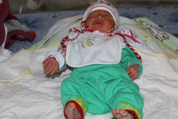 24 parmaklı bebek doğdu