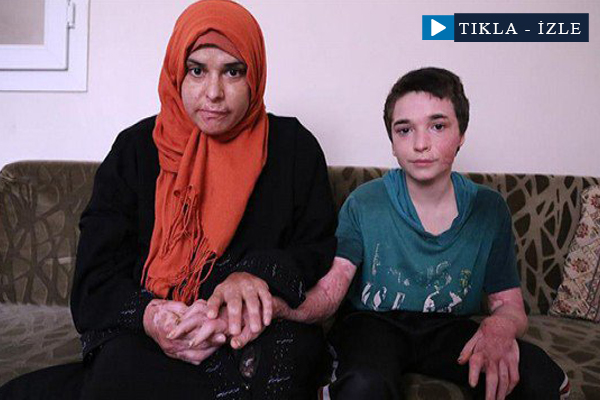 Bombalar anne ile oğlunu yaktı