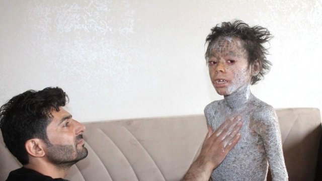 Büyük dram: Herkes benden korkuyor