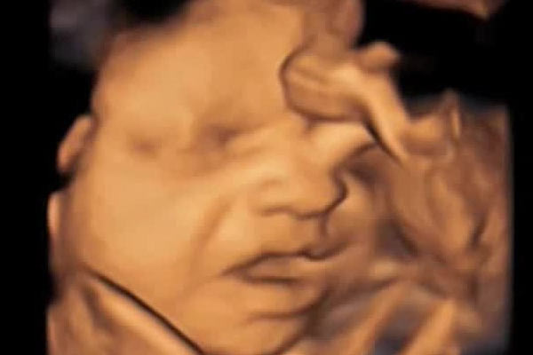 Kıbrıs'ta cenin operasyonu