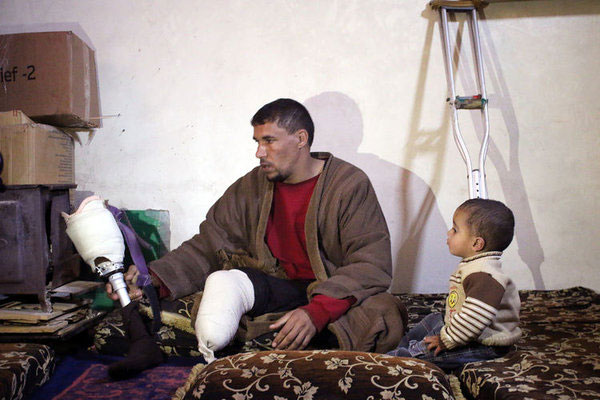 Bacağını kaybetti, namazdan vazgeçmedi