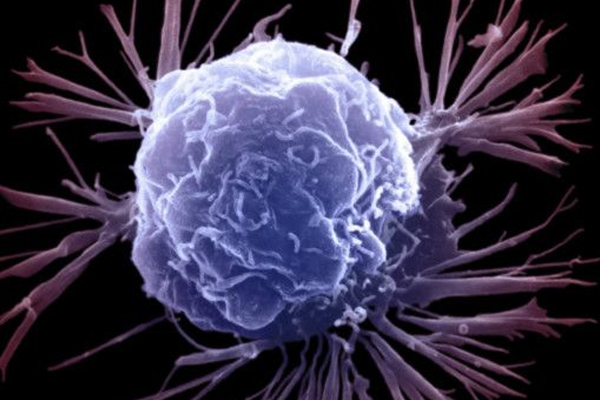 Kanser tedavisinde önemli buluş