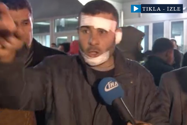 Görgü tanığı Ankara'daki patlamayı anlattı