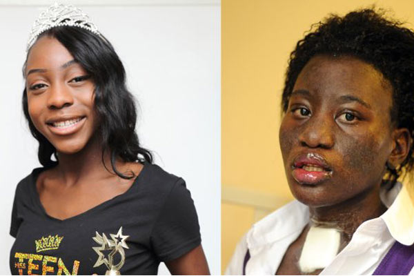 Göz damlası hayatını kararttı