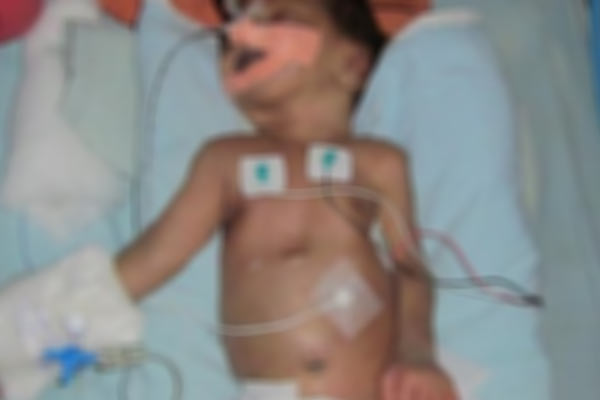 10 Aylık bebeği döverek komaya soktular