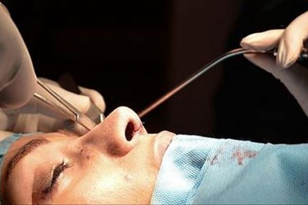 Avrupa Burun Cerrahisi Derneği: Türkiye, burun cerrahisinde dünyada en önde