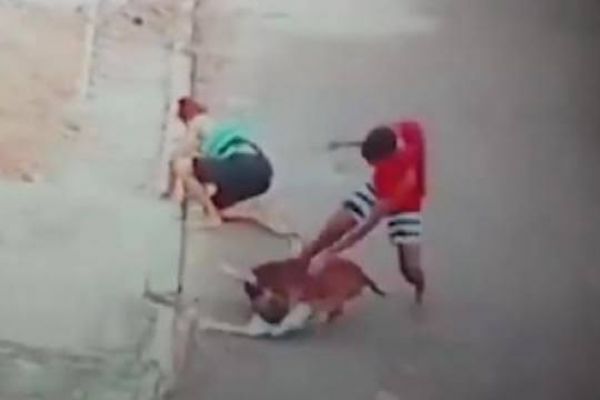 Pitbull çocuğa böyle saldırdı!