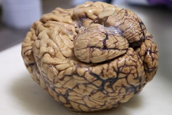 Bilim insanlarını şaşırtan gizemli beyin!