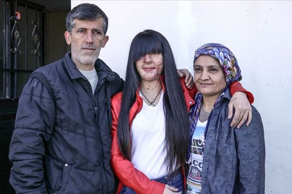 Asitli saldırı mağduru Berfin Özek ve ailesinden Erdoğan'a teşekkür