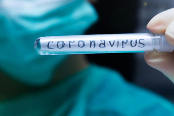 Ölü sayısı her geçen gün artıyor: Koronavirüs 1 günde 242 can aldı