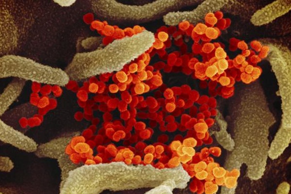 KKTC'de koronavirüs şüphesi ile hastaneye kaldırılan kişinin tahlil sonuçları belli oldu