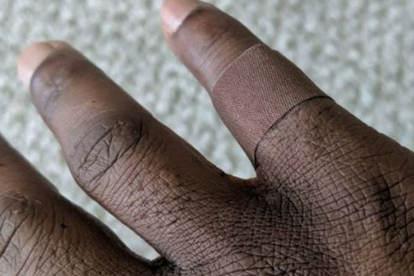 İngiltere'de siyahların ten rengine uygun yara bantları satışa çıktı