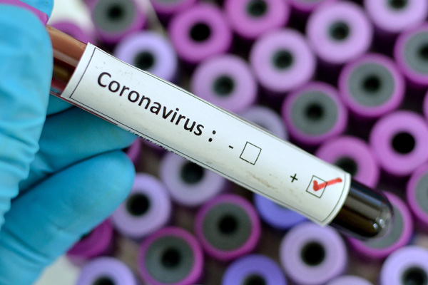 Suudi Arabistan, koronavirüs bulaşan vatandaşını Kuveyt'te tedavi edecek