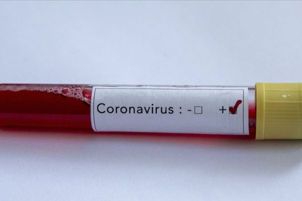 Irak, 6 ülkeye daha vize vermeyecek