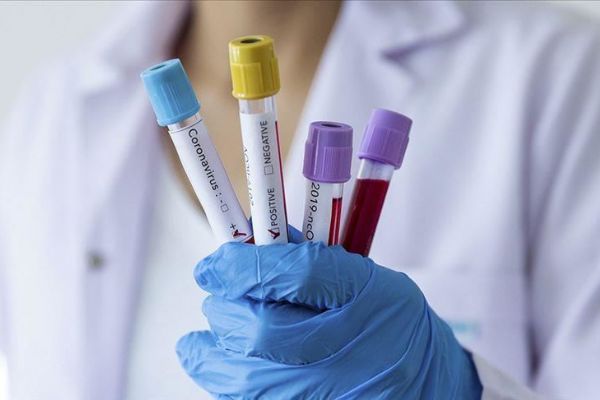 İran'da koronavirüs nedeniyle 8 kişi daha hayatını kaybetti