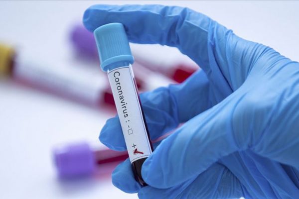 Dünyada Kovid-19 bulaşan kişi sayısı 85 bini aştı