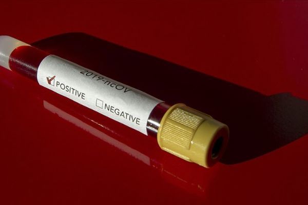 Koronavirüs Gazze'de: Refah'tan giriş yapacak herkes karantinaya alınacak