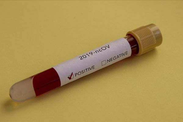 Arjantin'de koronavirüsten ilk ölüm