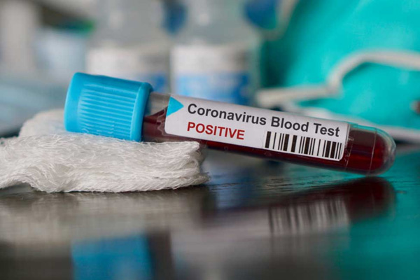 İranlı vekil: Ülkede koronavirüs dışında bir virüs daha var