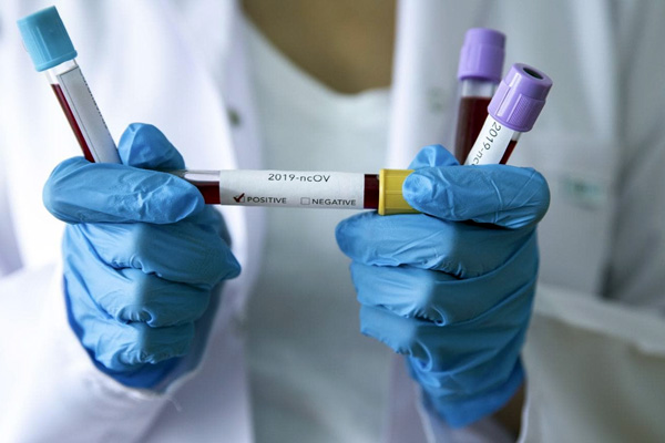 İran'da koronavirüs can almaya devam ediyor: Ölenlerin sayısı 291'e yükseldi