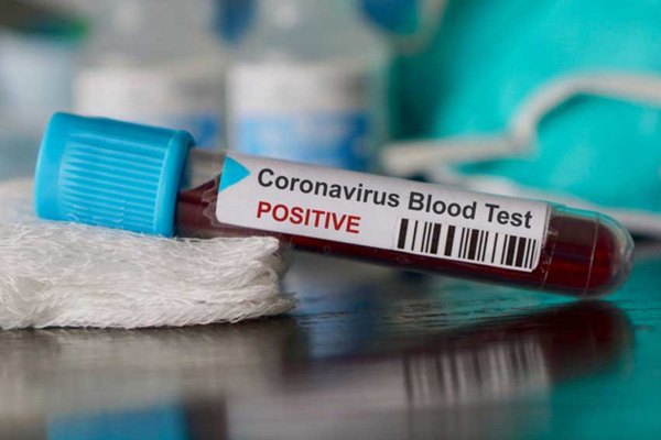 Koronavirüsün teşhisi de tedavisi de özel hastanelerde yapılamıyor