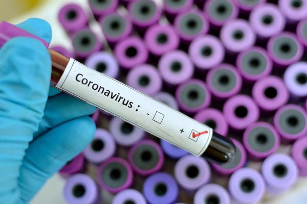 Bulgaristan'da olağanüstü hal ilan edildi!