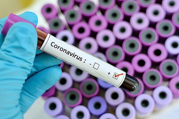 Koronavirüs testi nerede yapılır? İşte koronavirüs testi yapan hastaneler listesi