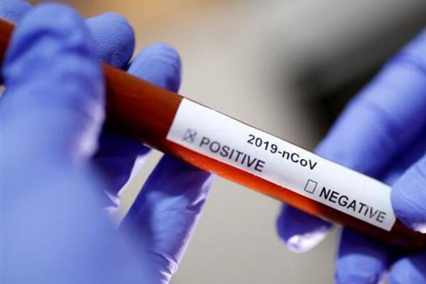 Çin koronavirüse karşı geliştirdiği aşıyı denemek için onay aldı