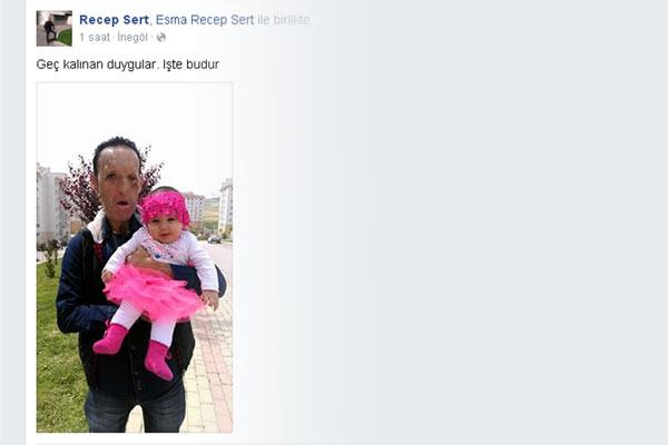 Önce yüz nakli, sonra baba oldu