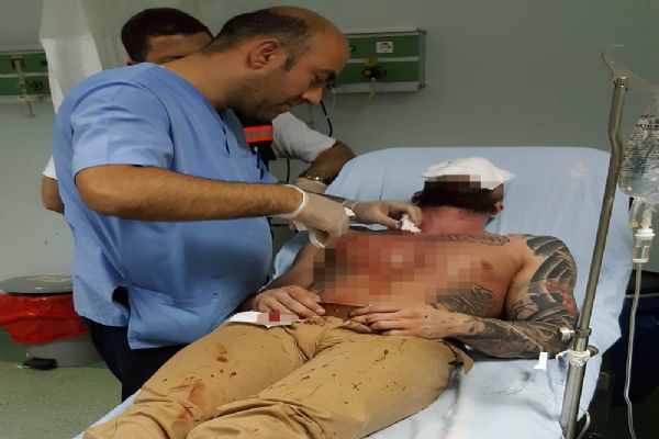 Komisyon kavgasında kan aktı