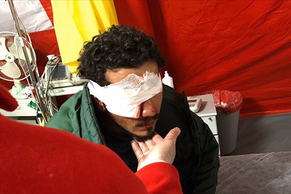 Yunanistan, sığınmacıyı gözünden etti