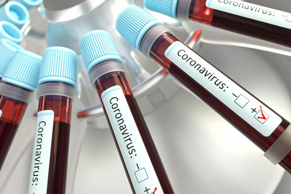 İsrail'de vaka sayısı 1238'e çıktı