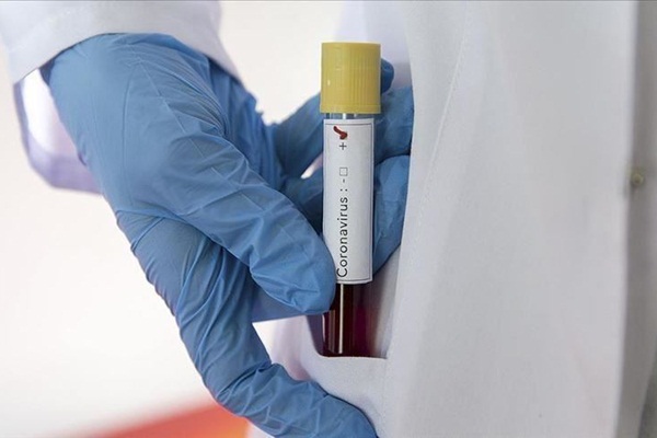 Suudi Arabistan'da Kovid-19 kaynaklı ilk ölüm