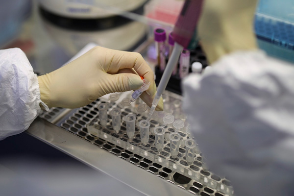 İngiltere'den ''test'' kararı: Halka dağıtılacak