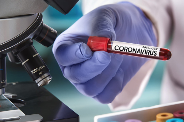 Rusya’da yeni test geliştirildi: Koronavirüs bağışıklığı kazananlar tespit edilecek