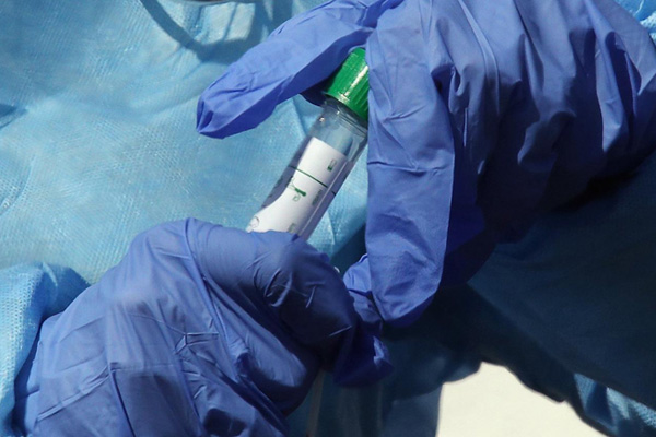 ABD'de yeni test kiti geliştirildi: 5 dakikada sonuç veriyor