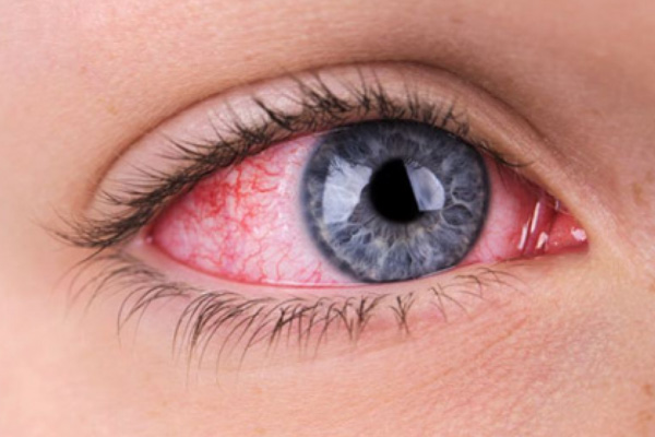 Koronavirüsün yeni bir belirtisi keşfedildi